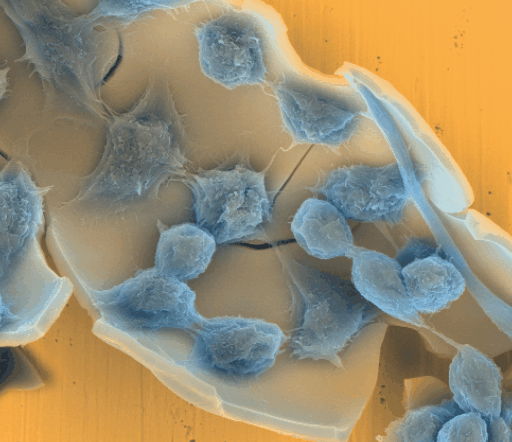 Cells on biocompatible ceramic — SE