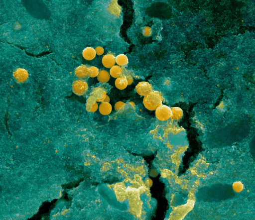 Gold nanoparticles — SE