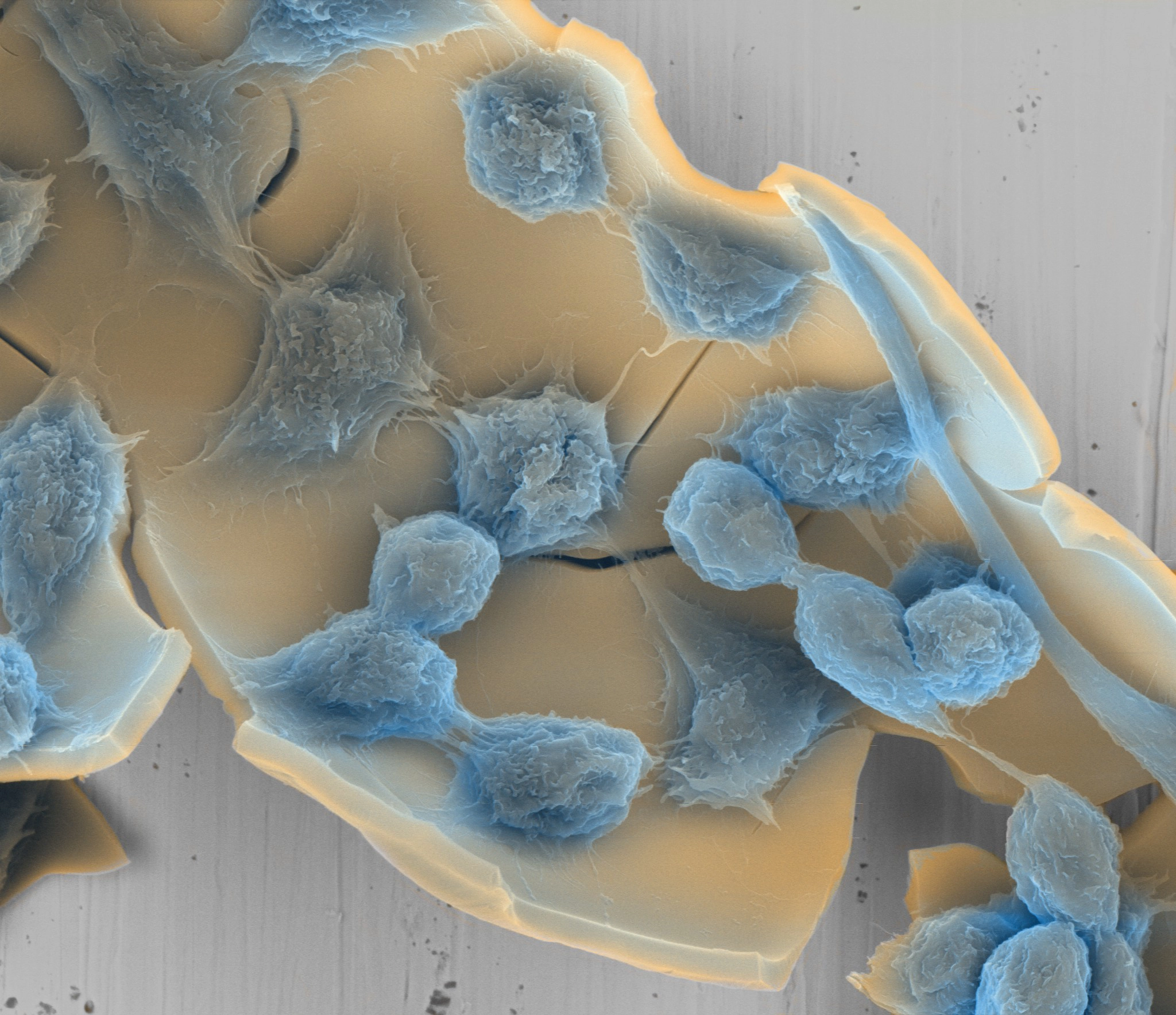 Cells grown on biocompatible ceramic surface — SE mode